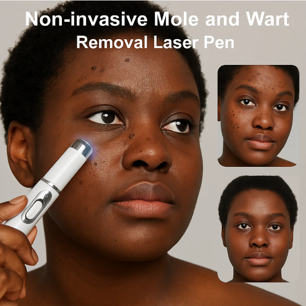 Stylo Laser ProMax – Grains & Verrues GN