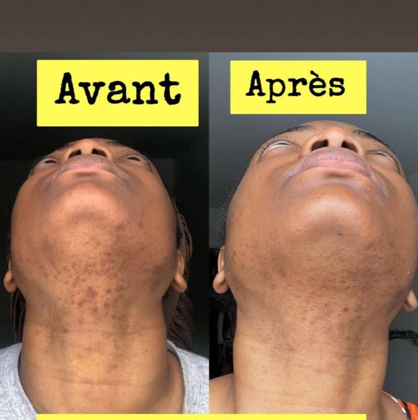 Le Savon anti - taches au curcuma | 100% Naturel (GN)
